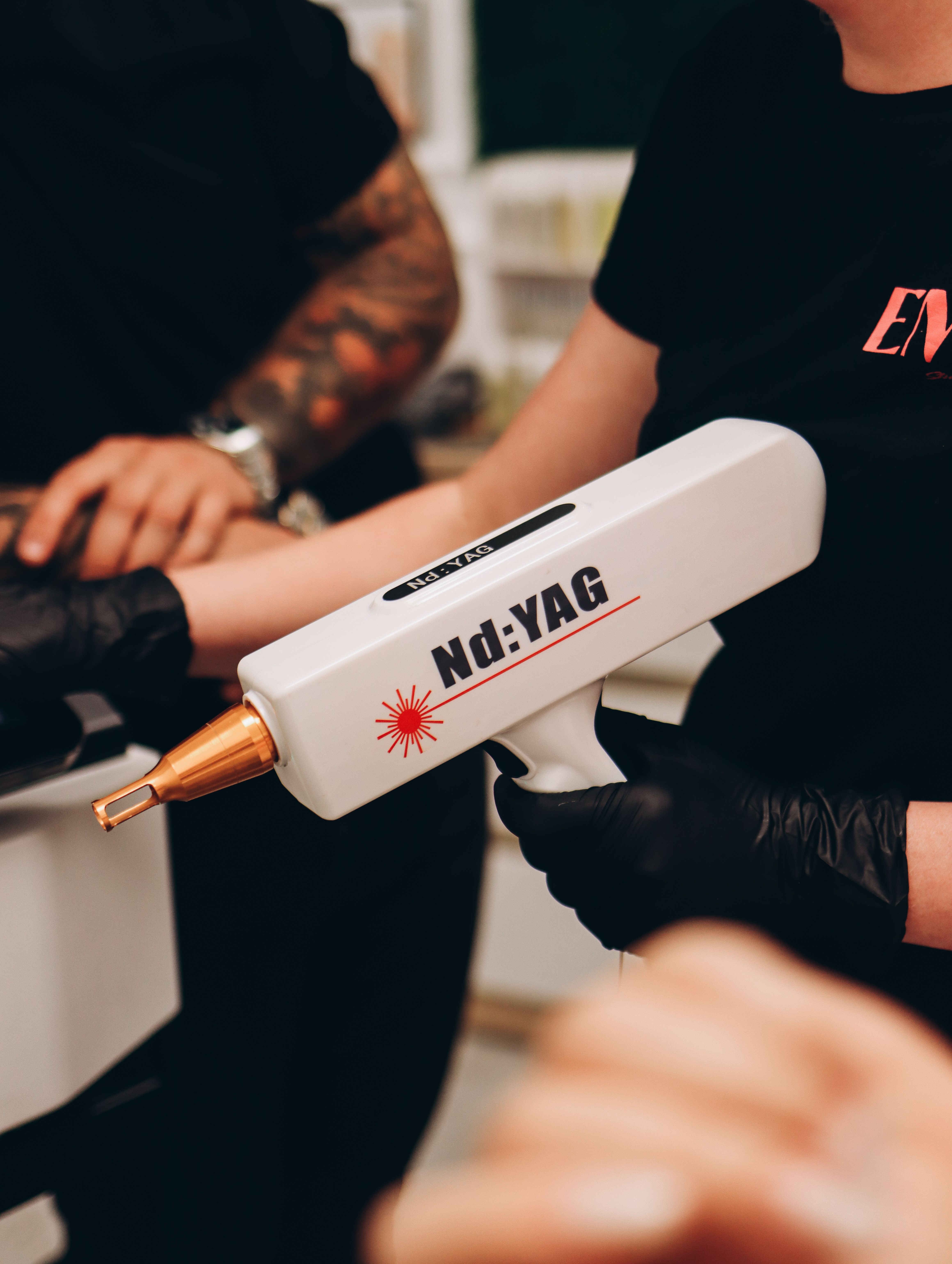 Clínica de remoção de tatuagem a laser